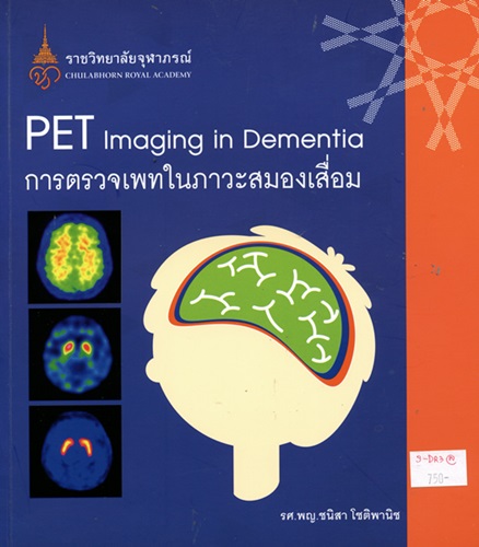 การตรวจเพทในภาวะสมองเสื่อม = PET imaging in dementia