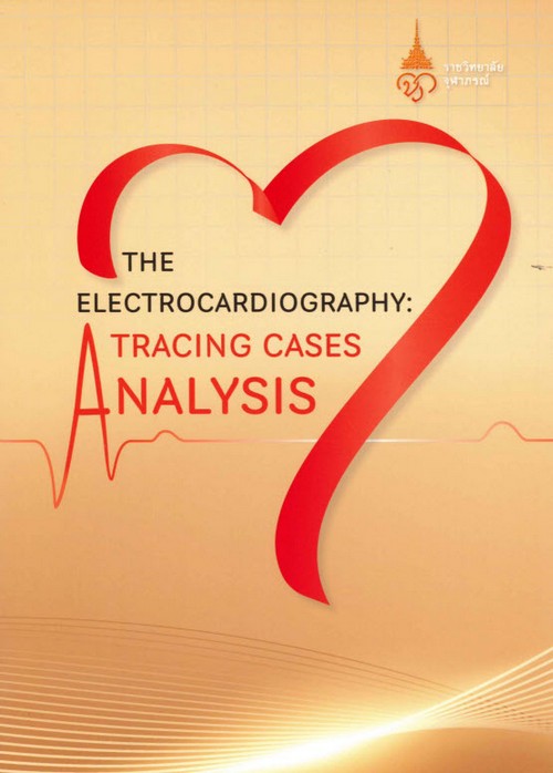 The Electrocardiography : tracing cases analysis