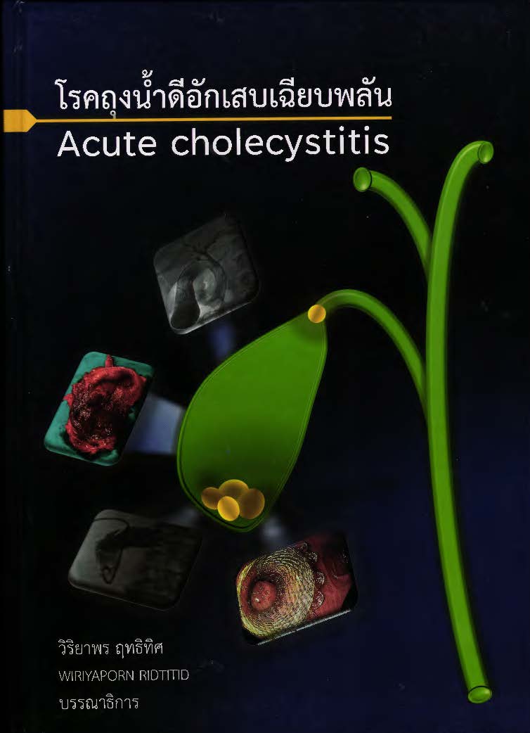 โรคถุงน้ำดีอักเสบเฉียบพลัน = Acute cholecystitis